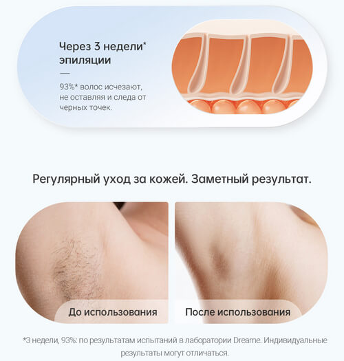 Фотоэпилятор Dreame IPL Home Use Hair Removal Device